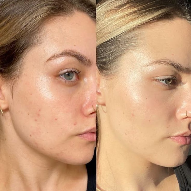 It gives me that fresh glow!