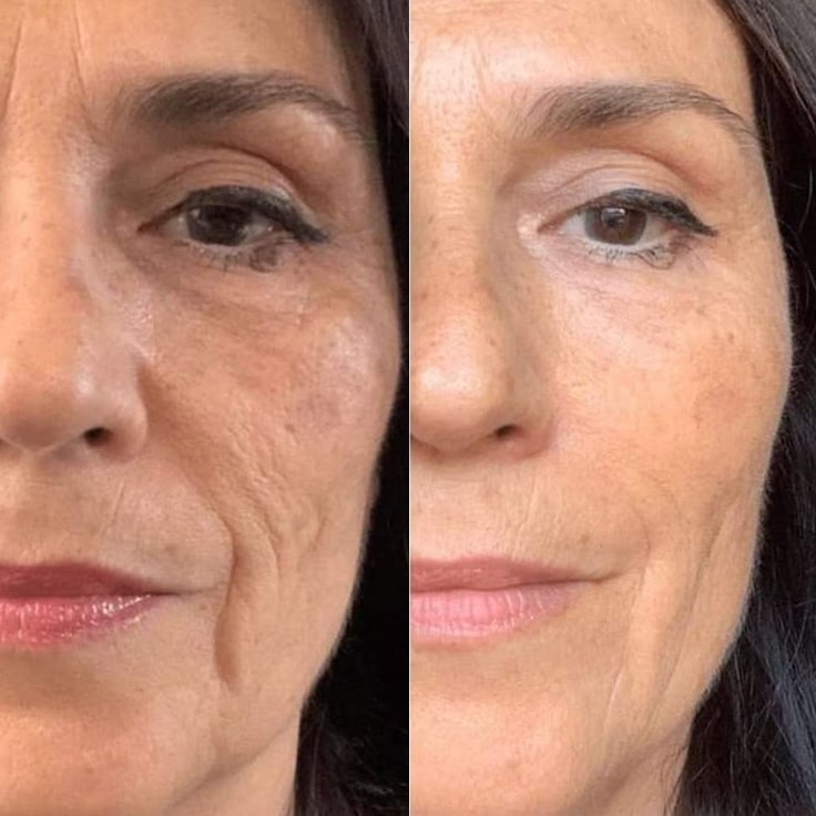 Reduces dark spots